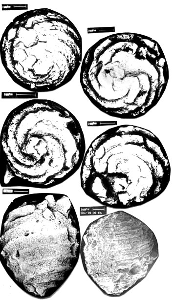 Scanning electron micrographs of spiral-ribbed charophyte gyrogonites.